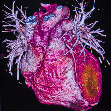 A 3D model of a heart.